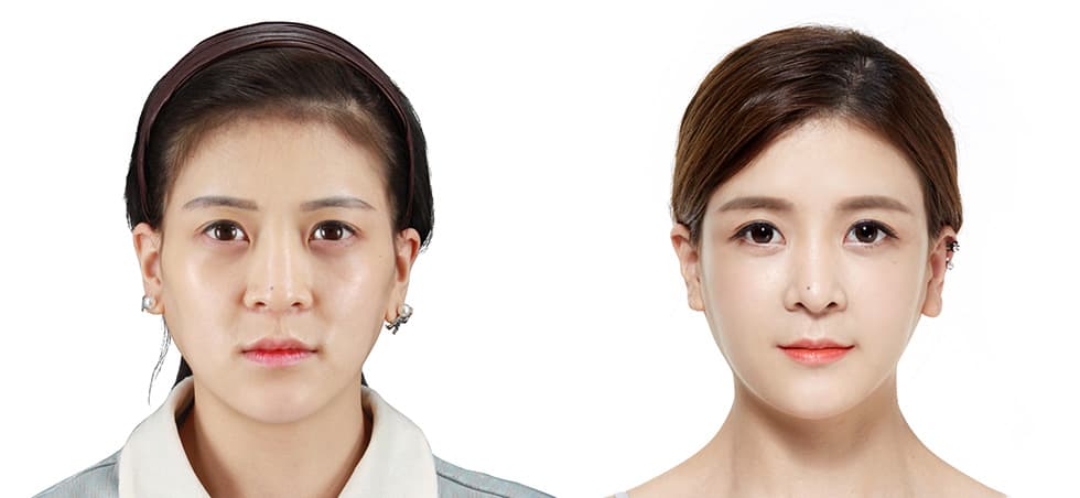 JK Plastic Surgery Center
